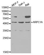 ARPC1A Antibody in Western Blot (WB)