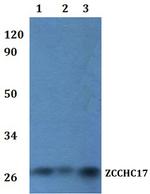 ZCCHC17 Polyclonal Antibody