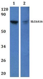SLC6A16 Polyclonal Antibody