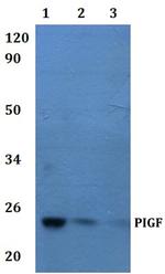 PIGF Polyclonal Antibody