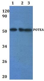 POTEA Polyclonal Antibody
