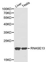 RNASE13 Antibody in Western Blot (WB)