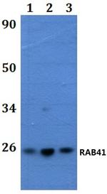 RAB41 Polyclonal Antibody