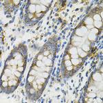 DEFB132 Antibody in Immunohistochemistry (Paraffin) (IHC (P))