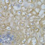 DEFB132 Polyclonal Antibody