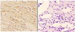 ABCA7 Polyclonal Antibody