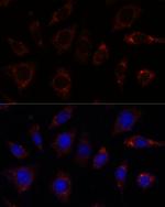 TBRG4 Antibody in Immunocytochemistry (ICC/IF)