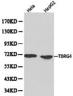 TBRG4 Antibody in Western Blot (WB)