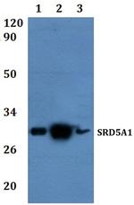 SRD5A1 Polyclonal Antibody