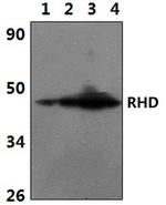 RHD Polyclonal Antibody