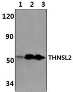THNSL2 Polyclonal Antibody