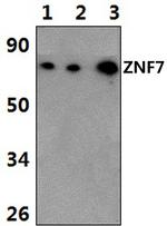 ZNF7 Polyclonal Antibody