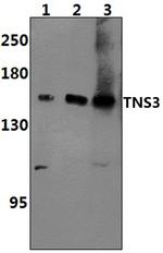 Tensin 3 Polyclonal Antibody