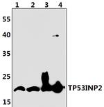 TP53INP2 Polyclonal Antibody