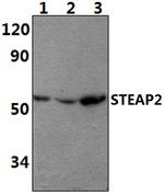 STEAP2 Polyclonal Antibody