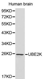 HIP2 Polyclonal Antibody