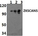 ZFP95 Polyclonal Antibody