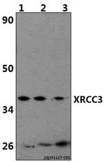 XRCC3 Antibody in Western Blot (WB)