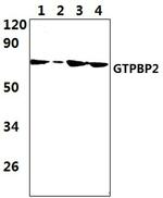 GTPBP2 Polyclonal Antibody