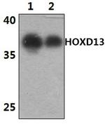 HOXD13 Polyclonal Antibody