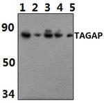 TAGAP Antibody in Western Blot (WB)