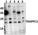 TRAPPC5 Antibody in Western Blot (WB)