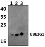 UBE2G1 Polyclonal Antibody