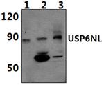 USP6NL Polyclonal Antibody