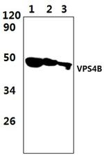 VPS4B Polyclonal Antibody