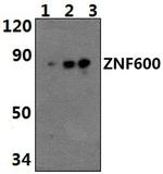 ZNF600 Polyclonal Antibody