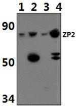 ZP2 Polyclonal Antibody