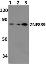 ZNF839 Polyclonal Antibody