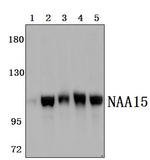 NAA15 Polyclonal Antibody