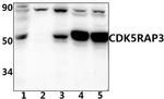 CCR11 Polyclonal Antibody