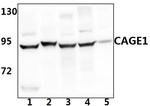 CAGE1 Antibody in Western Blot (WB)