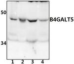 B4GALT5 Polyclonal Antibody