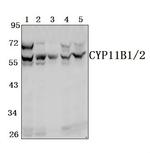 CYP11B1/CYP11B2 Polyclonal Antibody