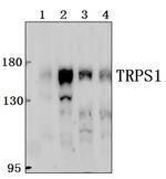 TRPS1 Polyclonal Antibody