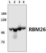 RBM26 Polyclonal Antibody