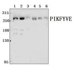 PIKFYVE Polyclonal Antibody
