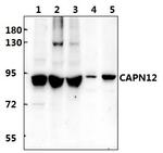 Calpain 12 Polyclonal Antibody