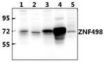 ZNF498 Polyclonal Antibody