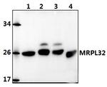 MRPL32 Polyclonal Antibody