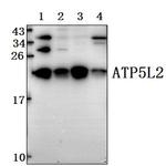 ATP5L2 Polyclonal Antibody
