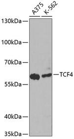 TCF4 Antibody in Western Blot (WB)