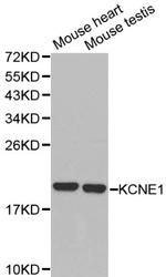 KCNE1 Polyclonal Antibody