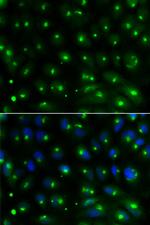 GGA2 Polyclonal Antibody