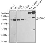 GGA2 Antibody in Western Blot (WB)