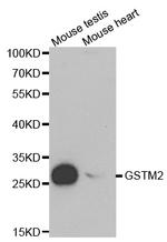 GSTM2 Polyclonal Antibody