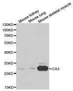 Carbonic Anhydrase III Antibody in Western Blot (WB)